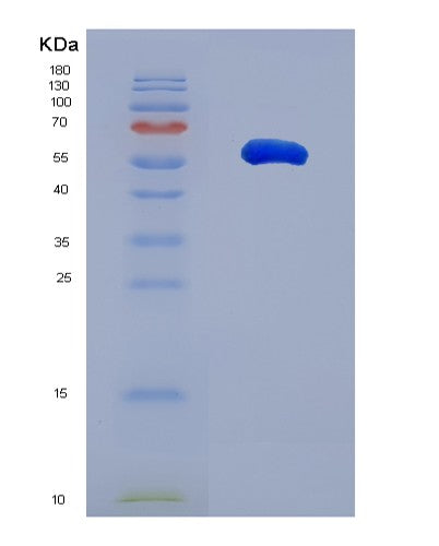Human BASP1 (Brain Acid Soluble Protein 1) - Recombinant Protein