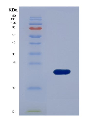 Human RBM3 (Rna-Binding Protein 3) - Recombinant Protein