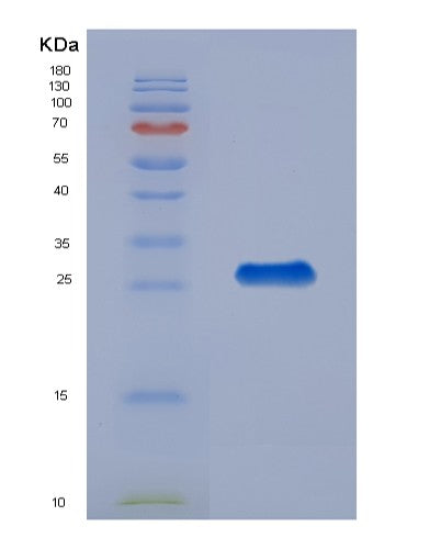 Human CDK16 (Cyclin-Dependent Kinase 16) - Recombinant Protein