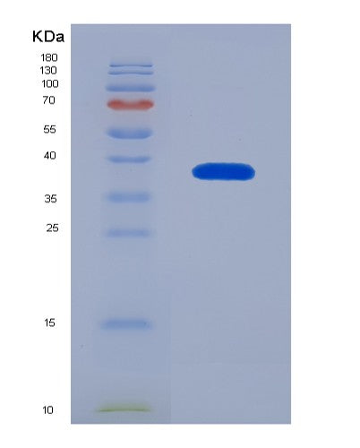 Human HSF1 (Heat Shock Factor Protein 1) - Recombinant Protein