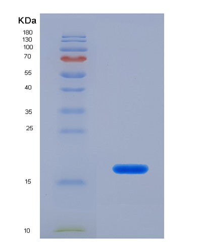 Human MYL7 (Myosin Regulatory Light Chain 2, Atrial Isoform) - Recombinant Protein