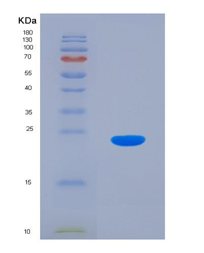 Human DR1 (Protein Dr1) - Recombinant Protein