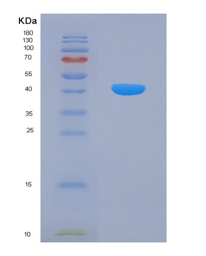 Human DHODH (Dihydroorotate Dehydrogenase (Quinone), Mitochondrial) - Recombinant Protein