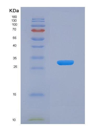 Human PRKCE (Protein Kinase C Epsilon Type) - Recombinant Protein