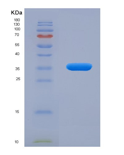 Human RELA (Transcription Factor P65) - Recombinant Protein