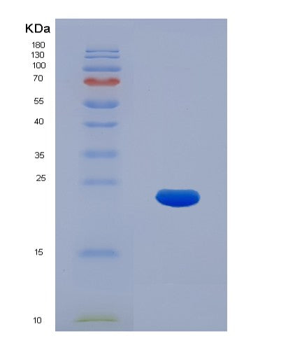 Human KRT17 (Keratin, Type I Cytoskeletal 17) - Recombinant Protein