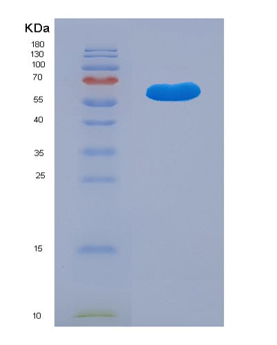 Human KDSR (3-Ketodihydrosphingosine Reductase) - Recombinant Protein