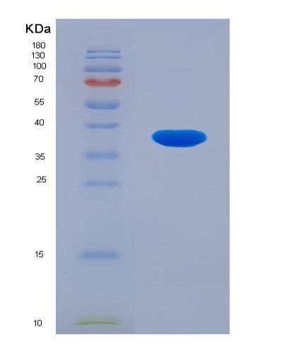 Human GFPT1 (Glutamine--Fructose-6-Phosphate Aminotransferase [Isomerizing] 1) - Recombinant Protein