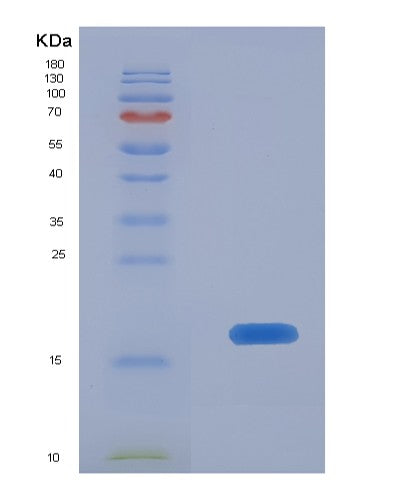 Human BST2 (Bone Marrow Stromal Antigen 2) - Recombinant Protein