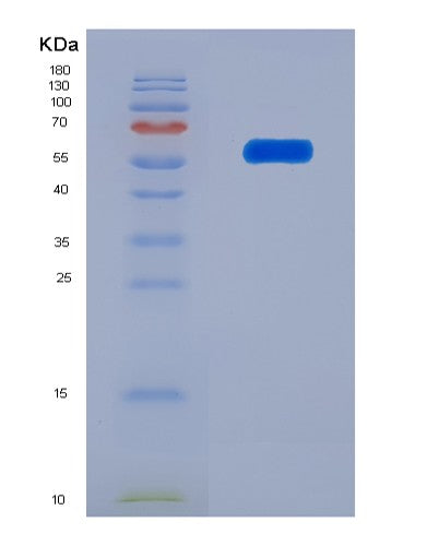 Human SCRN1 (Secernin-1) - Recombinant Protein