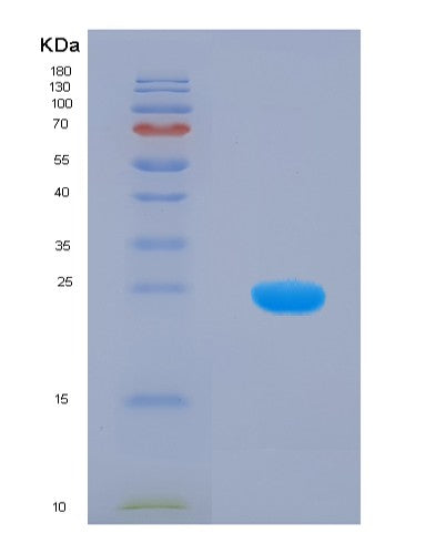 Human CETN1 (Centrin-1) - Recombinant Protein