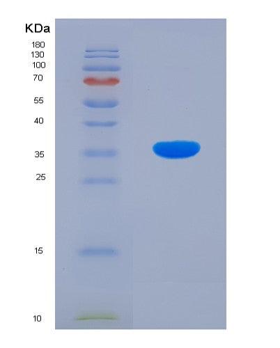 Human FSTL1 (Follistatin-Related Protein 1) - Recombinant Protein