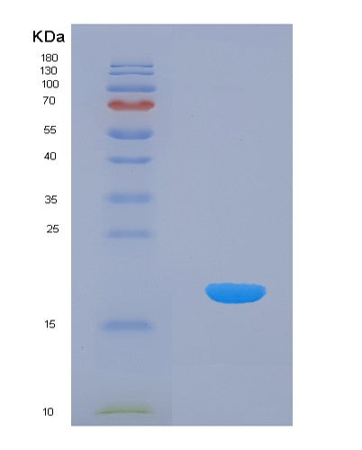 Human AIMP1 (Aminoacyl Trna Synthase Complex-Interacting Multifunctional Protein 1) - Recombinant Protein