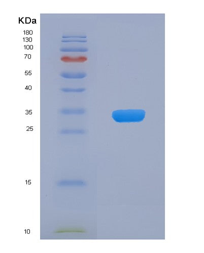 Human LMAN2 (Vesicular Integral-Membrane Protein Vip36) - Recombinant Protein