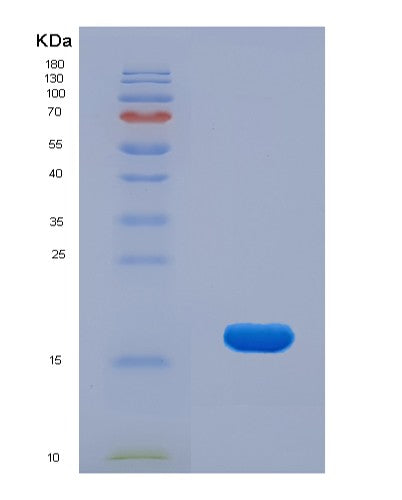 Human KLRB1 (Killer Cell Lectin-Like Receptor Subfamily B Member 1) - Recombinant Protein
