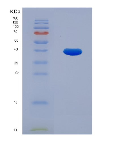 Human ECH1 (Delta(3,5)-Delta(2,4)-Dienoyl-Coa Isomerase, Mitochondrial) - Recombinant Protein