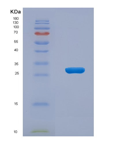 Human SLAMF1 (Signaling Lymphocytic Activation Molecule) - Recombinant Protein