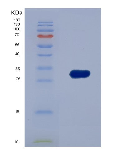 Human CTBP1 (C-Terminal-Binding Protein 1) - Recombinant Protein