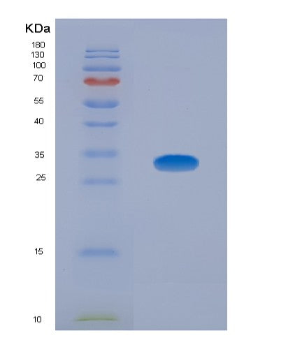 Human SQSTM1 (Sequestosome-1) - Recombinant Protein