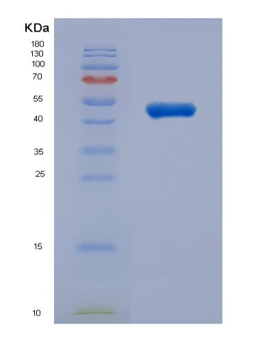 Human TUBB3 (Tubulin Beta-3 Chain) - Recombinant Protein