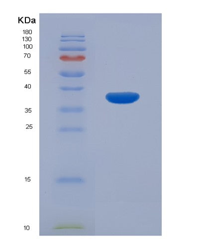 Human CAMK2B (Calcium/Calmodulin-Dependent Protein Kinase Type Ii Subunit Beta) - Recombinant Protein