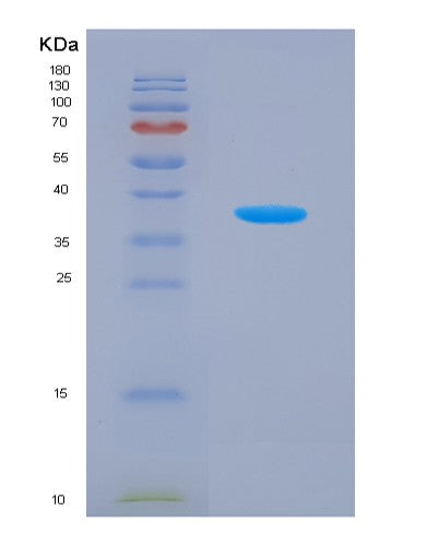 Human NAE1 (Nedd8-Activating Enzyme E1 Regulatory Subunit) - Recombinant Protein