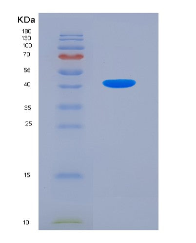 Human IRF5 (Interferon Regulatory Factor 5) - Recombinant Protein