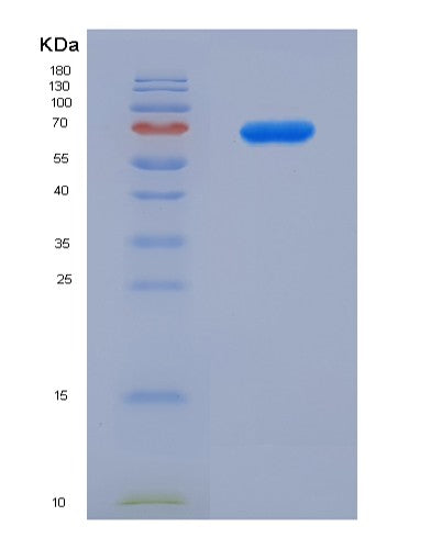 Human TDG (G/T Mismatch-Specific Thymine Dna Glycosylase) - Recombinant Protein