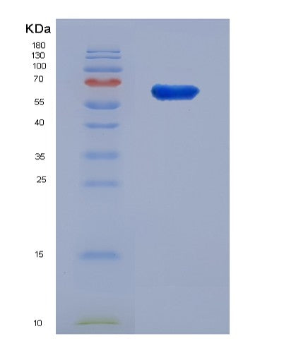 Human SNX1 (Sorting Nexin-1) - Recombinant Protein