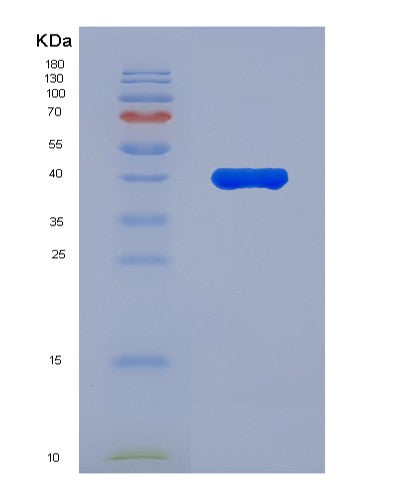 Human AUH (Methylglutaconyl-Coa Hydratase, Mitochondrial) - Recombinant Protein