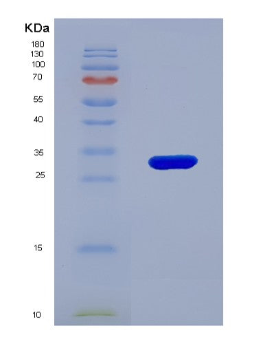 Human BLMH (Bleomycin Hydrolase) - Recombinant Protein