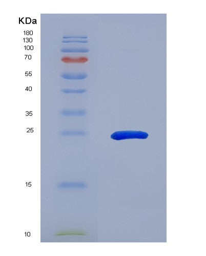Human CBFB (Core-Binding Factor Subunit Beta) - Recombinant Protein