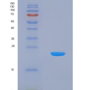 Human CIRBP (Cold-Inducible Rna-Binding Protein) - Recombinant Protein