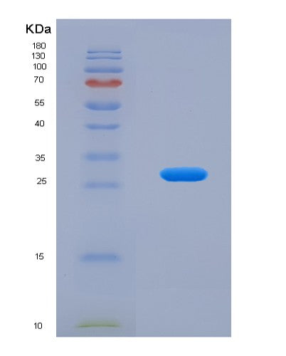 Human CRMP1 (Dihydropyrimidinase-Related Protein 1) - Recombinant Protein