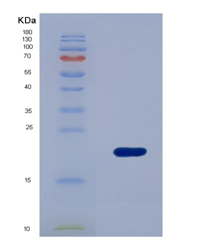 Human WTAP (Pre-Mrna-Splicing Regulator Wtap) - Recombinant Protein