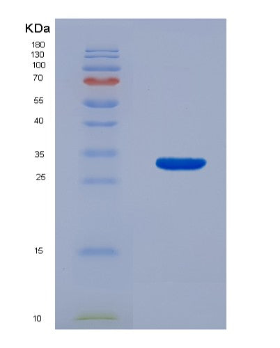 Human KARS1 (Lysine--Trna Ligase) - Recombinant Protein