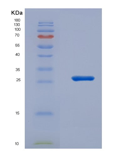 Human NCF4 (Neutrophil Cytosol Factor 4) - Recombinant Protein