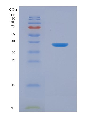Human ANKRD1 (Ankyrin Repeat Domain-Containing Protein 1) - Recombinant Protein