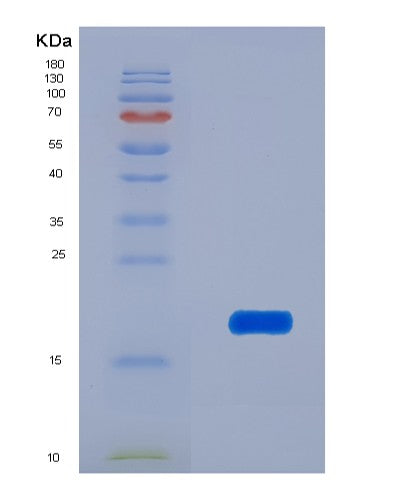 Human ANGPT1 (Angiopoietin-1) - Recombinant Protein