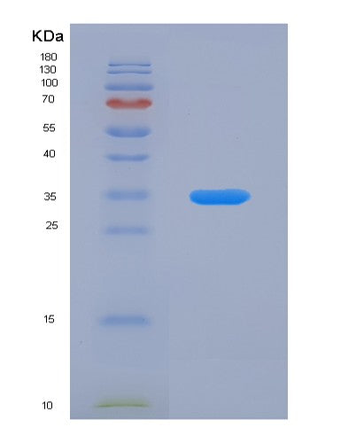 Human RSU1 (Ras Suppressor Protein 1) - Recombinant Protein
