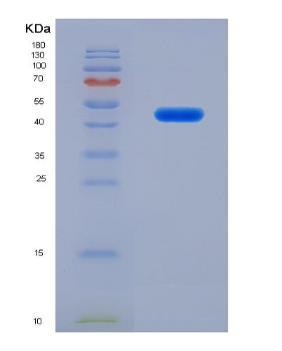 Human CYTH1 (Cytohesin-1) - Recombinant Protein