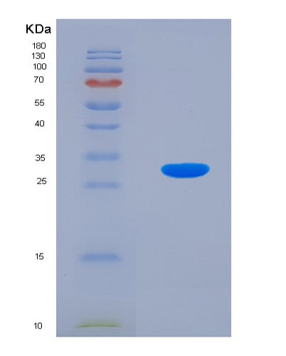 Human RGN (Regucalcin) - Recombinant Protein