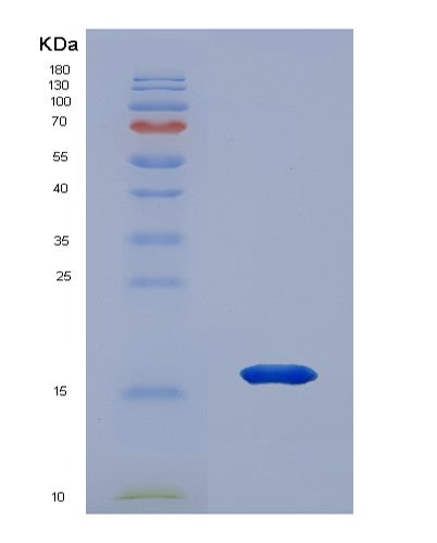 Human HMGN3 (High Mobility Group Nucleosome-Binding Domain-Containing Protein 3) - Recombinant Protein