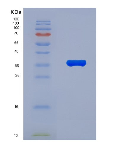 Human TSC22D1 (Tsc22 Domain Family Protein 1) - Recombinant Protein