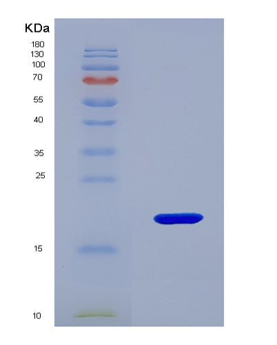 Human KISS1 (Metastasis-Suppressor Kiss-1) - Recombinant Protein