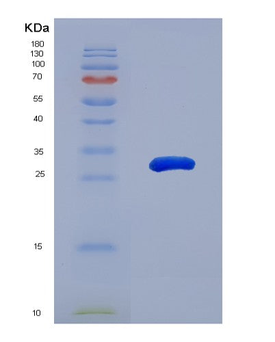 Human MAPK11 (Mitogen-Activated Protein Kinase 11) - Recombinant Protein