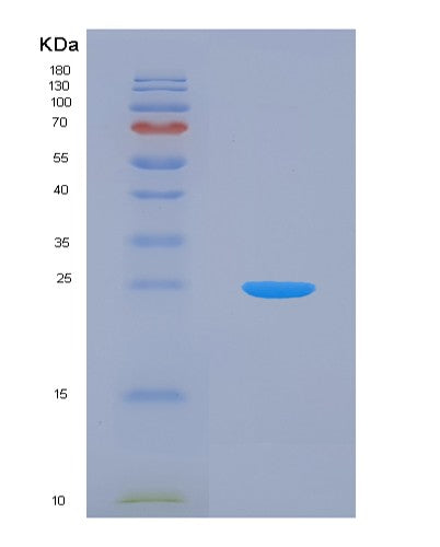 Human HSPB2 (Heat Shock Protein Beta-2) - Recombinant Protein