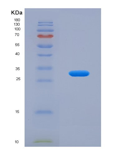 Human SGCB (Beta-Sarcoglycan) - Recombinant Protein