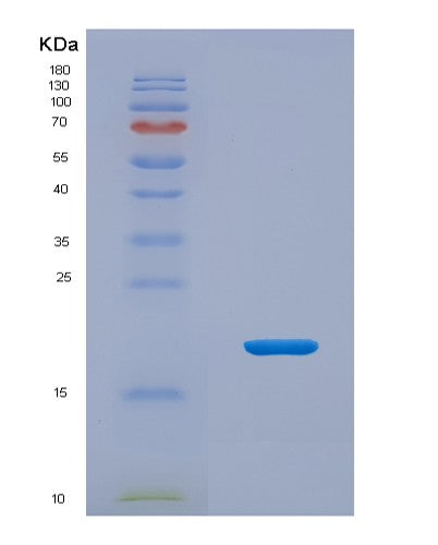 Human MOG (Myelin-Oligodendrocyte Glycoprotein) - Recombinant Protein