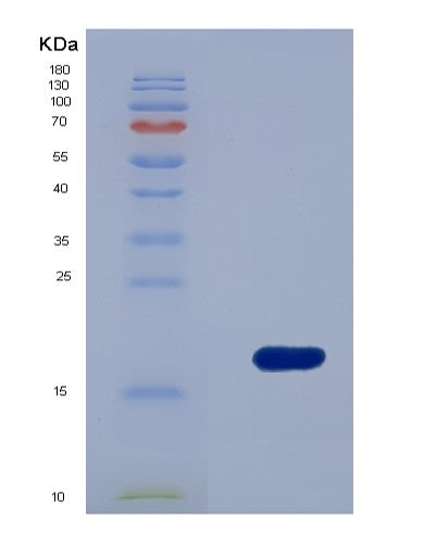 Human FSCN1 (Fascin) - Recombinant Protein